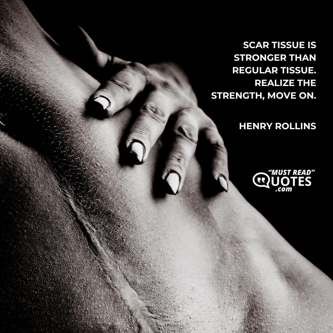 Scar tissue is stronger than regular tissue. Realize the strength, move on.