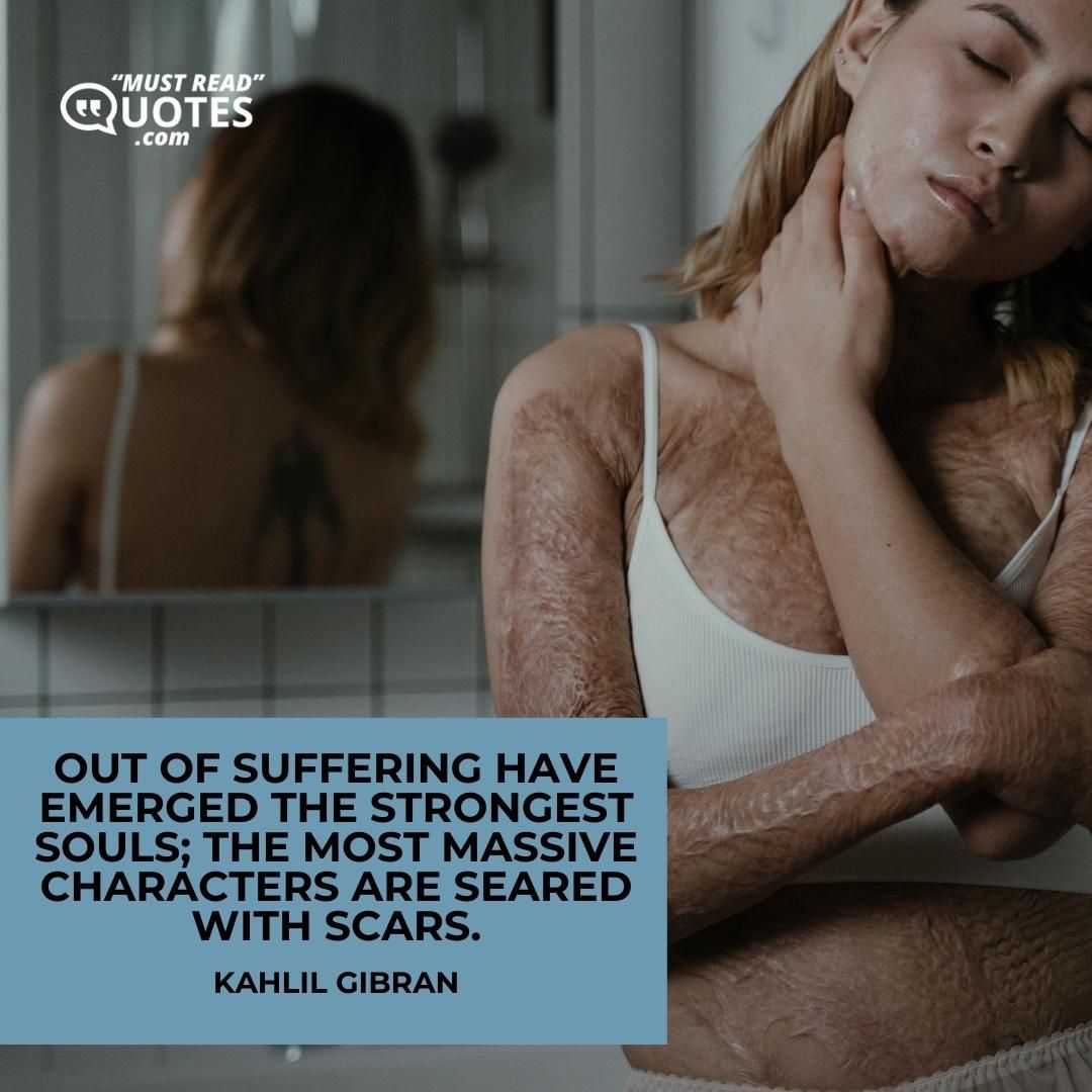 Out of suffering have emerged the strongest souls; the most massive characters are seared with scars.