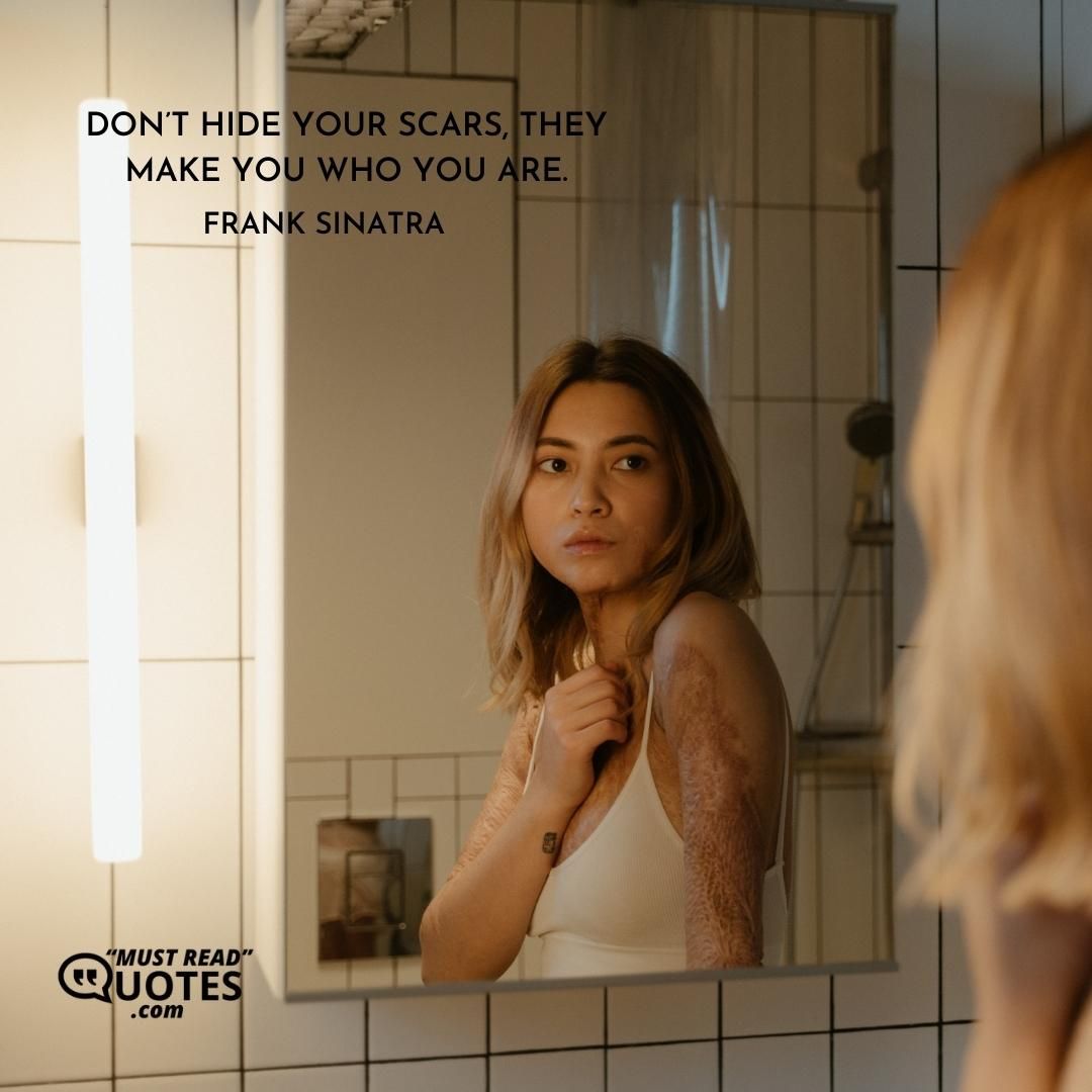 Don’t hide your scars, they make you who you are.