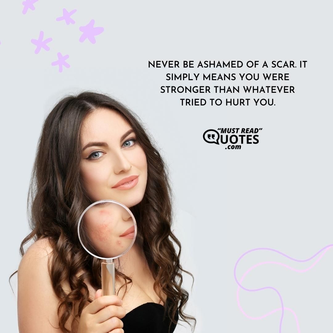 Never be ashamed of a scar. It simply means you were stronger than whatever tried to hurt you.