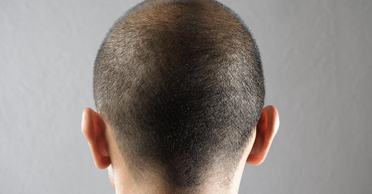 Head