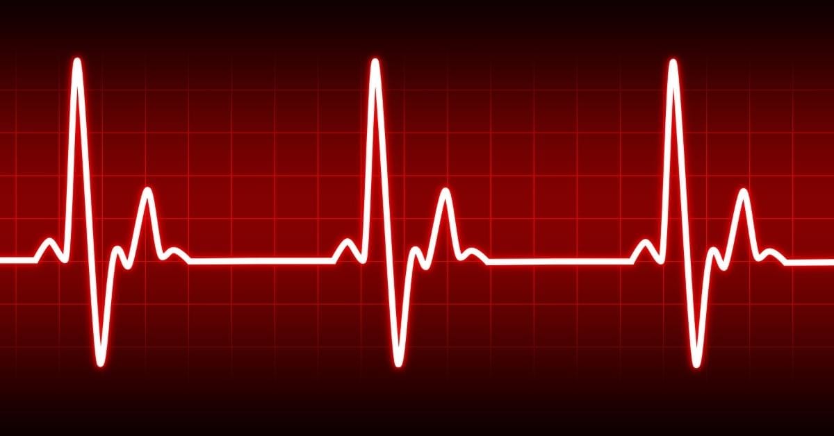 Heartbeat