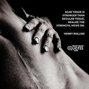 Scar tissue is stronger than regular tissue. Realize the strength, move on.