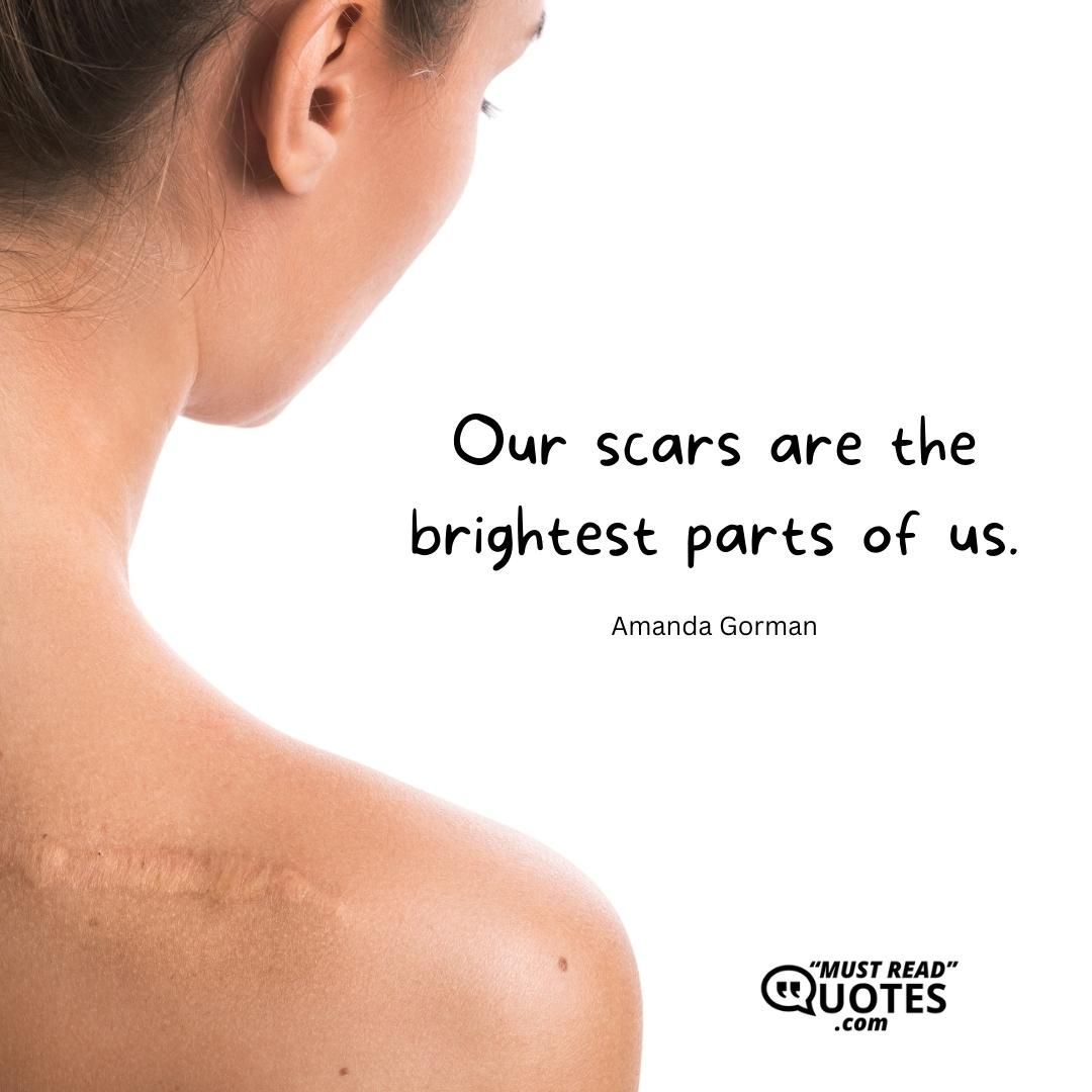 Our scars are the brightest parts of us.