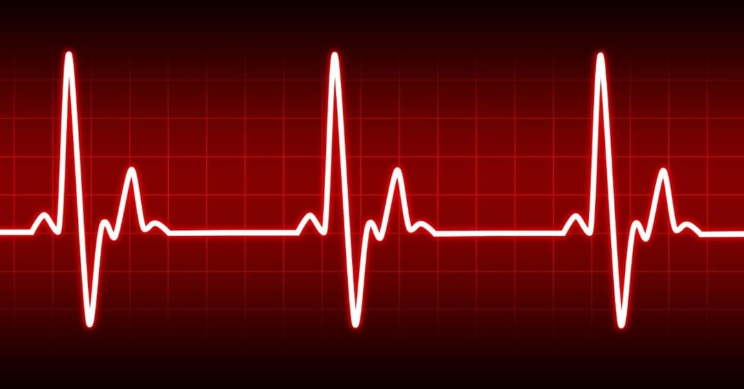 Heartbeat